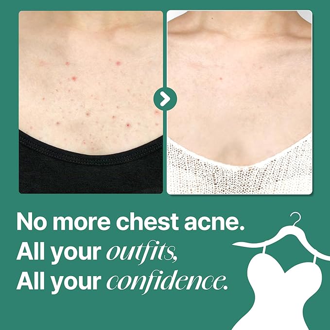 SOME BY MI AHA BHA PHA 30 Days Miracle Acne Clear Body Cleanser & Beta-Panthenol Repair Body Cream
