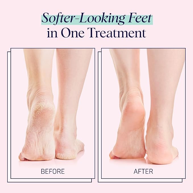 SpaLife Moisturizing Foot Sockies | Foot Mask For Dry Cracked Feet | Tea Tree Oil Softening Booties | Callus Remover Alternative | Self Care Gifts for Women | 8 Pack