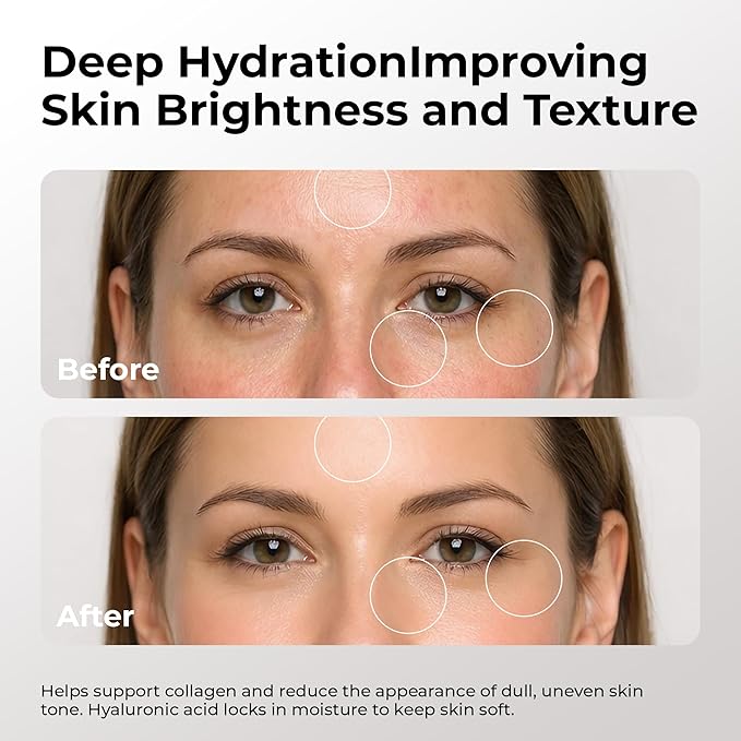Skin Deva Vitamin C and Hyaluronic Acid Serum for Face Matrixyl 3000 Anti Aging Serum, Anti Wrinkle Facial Serums - Improve Appearance of Dark Spots, Tone, Fine Lines, Glowing -(PACK OF 2)