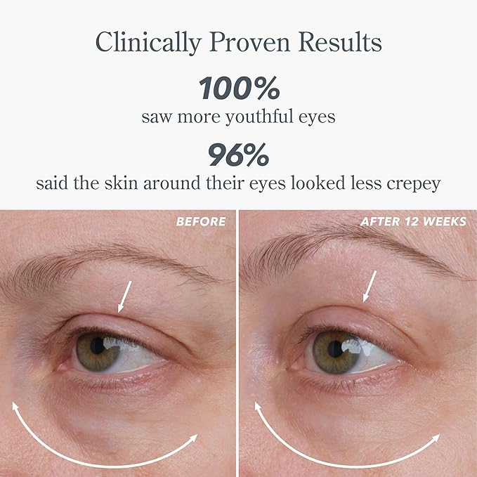 Beekman 1802 Milk RX Advanced Better Aging Dual Eye Treatments – Under Eye Wrinkle Cream & Eyelid Lift Serum with Peptides & Goat Milk Exosomes, Retinol Alternative