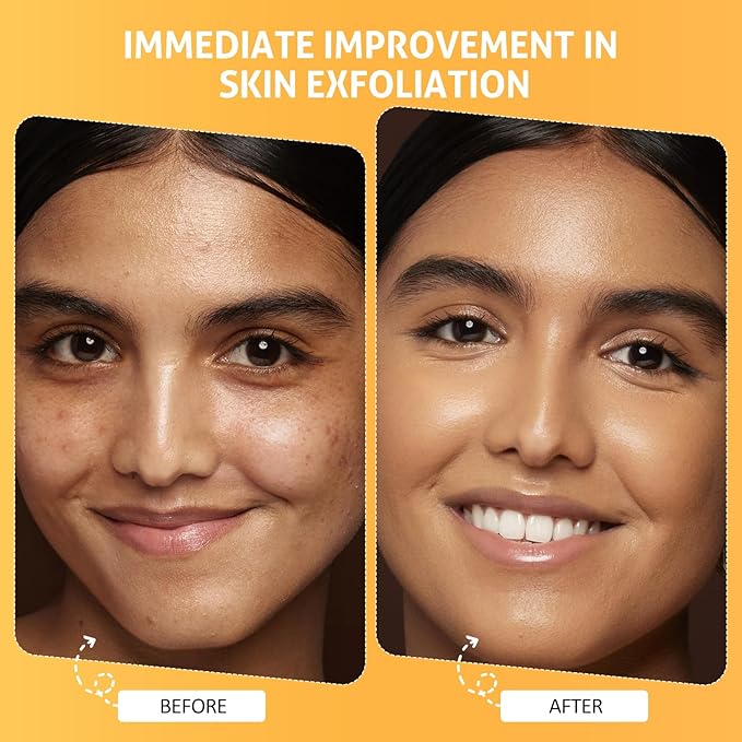 RIHAKO Easter Gifts for Women Pumpkin Enzyme Face Mask Skincare| Brightening Exfoliating Facial Mask For Dead Skin,Dullness Dark Spots, Uneven Skin Tone,Large Pores and Brightens Skin