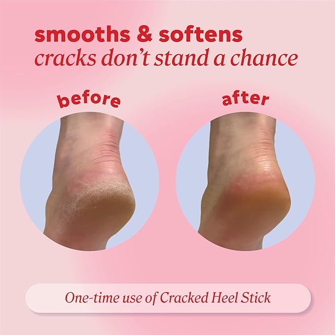 Onyx Professional Cracked Heel Repair Balm Stick for Dry Cracked Feet Treatment, Citrus Scent, 2 pack - Moisturizing Foot Balm, Rolls On, No Mess Like Foot Cream or Foot Lotion, Heel Treatment