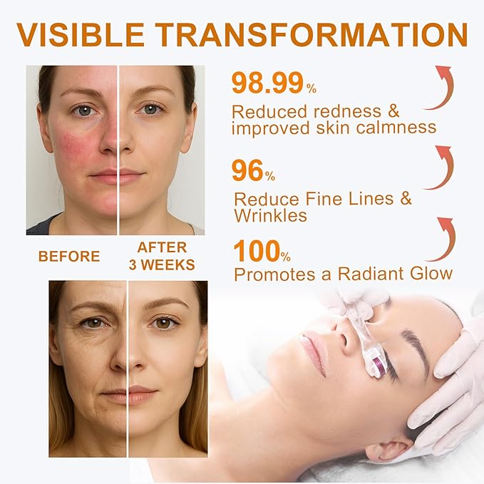 Salmon DNA PDRN Face Serum: Recovery Serum with EGF Peptide Collagen Growth Factor for Sensitive & Post-Microneedling - Soothe Redness & Repair Skin Barrier in 72 Hours - 1 Fl Oz