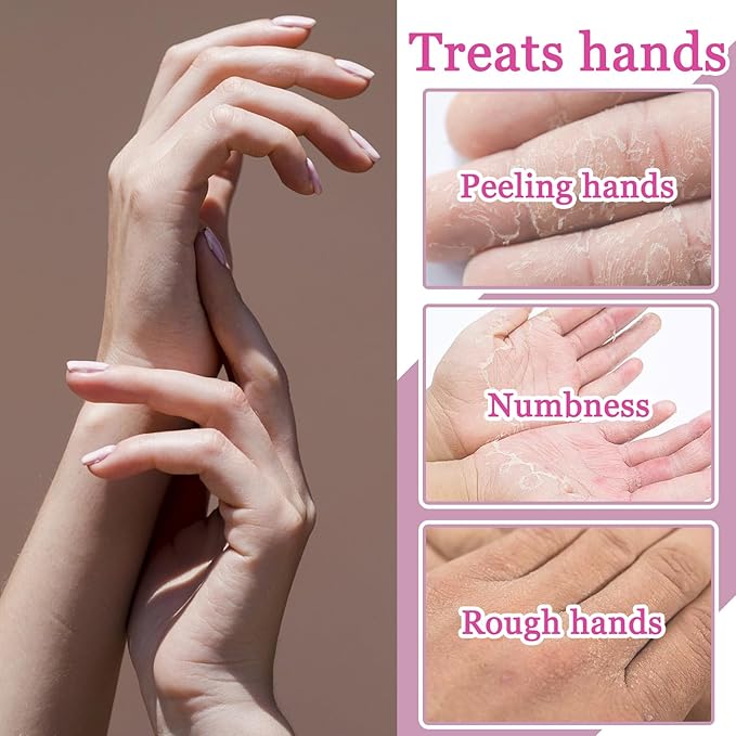 Hydrating Hand Masks, 6PCS Hand Mask Moisturizing Gloves for Men Women, Smooth Long Lasting Soft Exfoliating Hand Peeling Spa Mask Moisturizer Beauty Gift Set for Dry Cracked Rough Dull Hands（E)