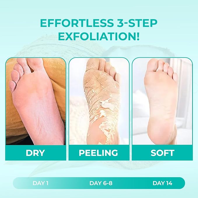 Happy Feet Coconut Exfoliating Foot Peel Mask – 3 Pack | Foot Peeling Mask for Dead Skin Removal, Smoother & Softer-Looking Feet, At-Home Foot Care Spa Treatment