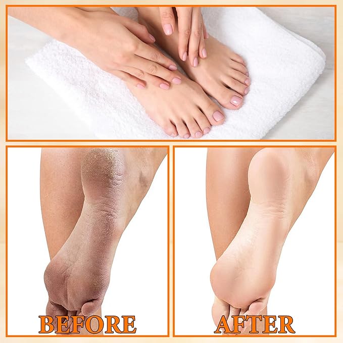 6PCS Foot Peel Mask,Exfoliating Foot Mask for Remove Dead Skin,Hydrating Foot Care Mask,Peel Off Mask for Calluses & Dry Toe Cracked Rough,Quickly Moisturizing & Nourishing Feet