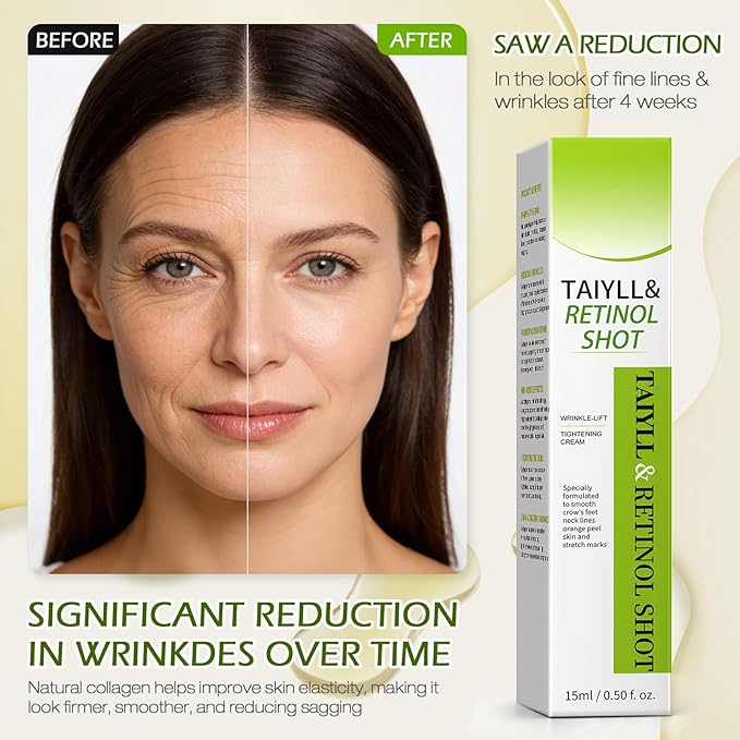 Botoxmix &Vita-A Retinol Shot Cream,Retinal Shot Tightening Booster, Retinol Anti-Wrinkle Cream, Anti-Aging, Reduces Fine Lines, Wrinkles & Crow’s Feet, Pore Minimizer, Firmer Skin