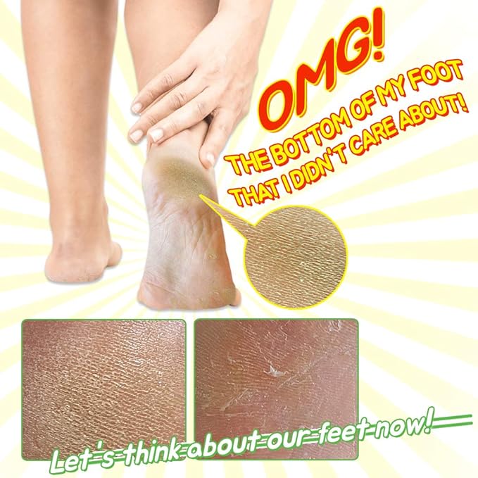 Elizavecca/Foot Peel /1 Foot Pack 2 Pairs Foot Mask - Boots for Exfoliating/foot pack review/foot pack before and after