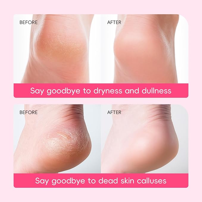 LAIKOU Japan Sakura Moisturizing Foot Mask, Foot Mask for Dry Cracked Feet, Foot Masks, Deep Moisturizing Socks for Cracked Heels, Skin Care Gifts for Women Soft Smooth Touch Feet 5 Pack