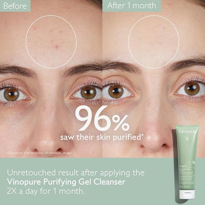 Caudalie Vinopure Salicylic Acid Cleanser, Pore Purifying Gel Cleanser - 150 mL (Pack of 2)