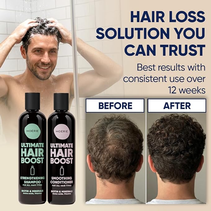 Moerie Hair Growth Shampoo and Conditioner for Women and Men, Hair Loss Solution with Biotin and Rosemary, Thickening Shampoo and Conditioner for Thinning Hair – Promotes Regrowth