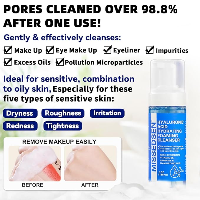 Face Wash for Acne and Oily Skin, Oil Control Foaming Cleanser, Fragrance Free, 5 oz (1, blue)