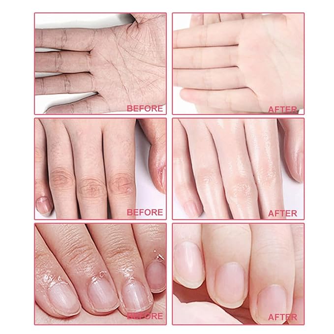 VolksRose 5 Pairs Hand Mask Gloves with Rose & Milk - Moisturizing Hand Mask for Dry Cracked Hands Overnight Repair Treatment, Intensive Hydration Spa Gloves for Women, Self Care Gifts for Rough Skin