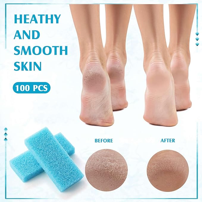 Batiyeer 100 Pcs Pumice Stone for Feet Scrubber Dead Skin Disposable Pedicure Pumice Stone Foot Shower Scrubber for Heel Cuticle Callus Remover Bath Spa (Sky Blue)