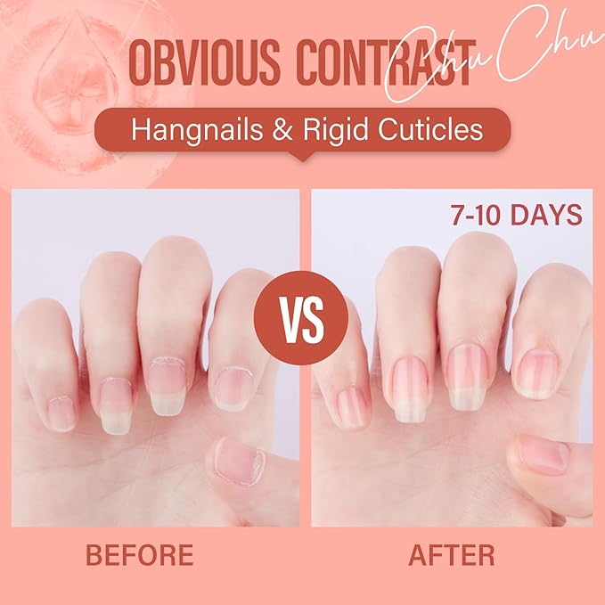 CHUCHU Vegan Cuticle Oil for Nail: Pomegranate Scent Natural Vitamin B & E Nail Oil - Hydrates Moisturizes Repairs for Nails Damage Dry Cuticle 0.51 Fl Oz
