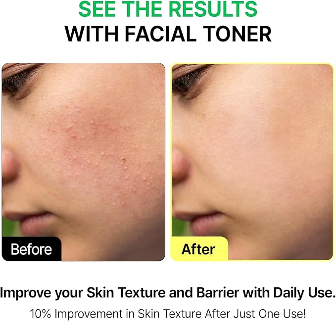VEGANIFECT Green Barley First Essence, Deep Hydration & Smooth Skin Texture with AHA and Rice, Gently Removes Sebum, Low-Irritation Vegan Korean Skincare for Glowing Skin, 200ml / 6.76 fl oz
