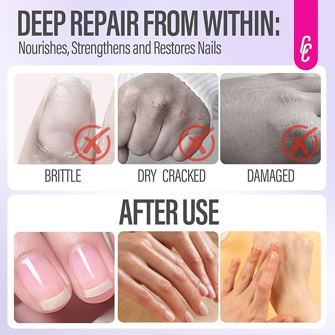 CHUCHU Nail Growth Serum for Summer: 15ML Lavender Organic Nail Oil with Vitamin B & E - Moisturizes Repairs and Promotes Nail Growth - Prevents Dryness Hangnails Non-Greasy