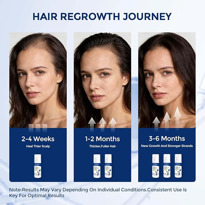 Hair Growth Spray,Hair Growth Serum for Women & Men,Hair Regrowth Treatment with Biotin & Rosemary Oil,Hair Loss Treatment Spray for Thinning Hair,Non-Greasy Scalp Care,2.029 Fl Oz