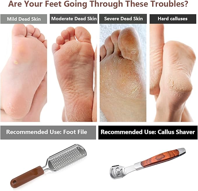 Colossal Foot Rasp & Wood Handle Callus Shaver (10 Replacement & 1 File Foot Heads), Pedicure Foot File Kit, Heel Scraper for Feet, Foot File Callus Remover