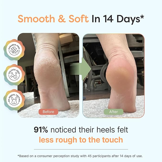 ZenToes Urea Cream 40 Percent for Feet | Foot Lotion for Dry Cracked Heels and Feet | Intense Dry Feet Softening and Hydration for Skin | Heel Balm and Moisturizing Care | 5oz