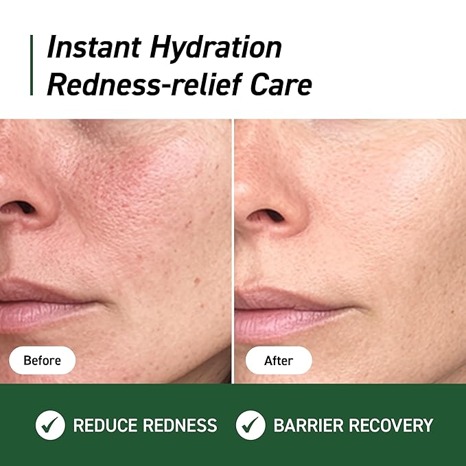 IVOSKIN Cica Redness Relief Treatment Cream, Soothing & Hydrating Green Correcting Moisturizer with Madecassoside, Helps Repair Skin Barrier for Sensitive Skin, Vegan, Korean Skincare (1.76oz / 50g)