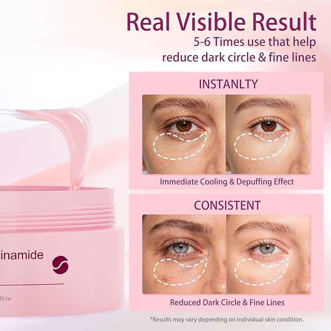 70Pcs Caffeine Peptide Under Eye Patches for Dark Circles Puffiness, Eye Masks with Rose Essence Hyaluronic Acid Niacinamide Anti Wrinkle & Fine Lines Hydrating & Cooling for Women