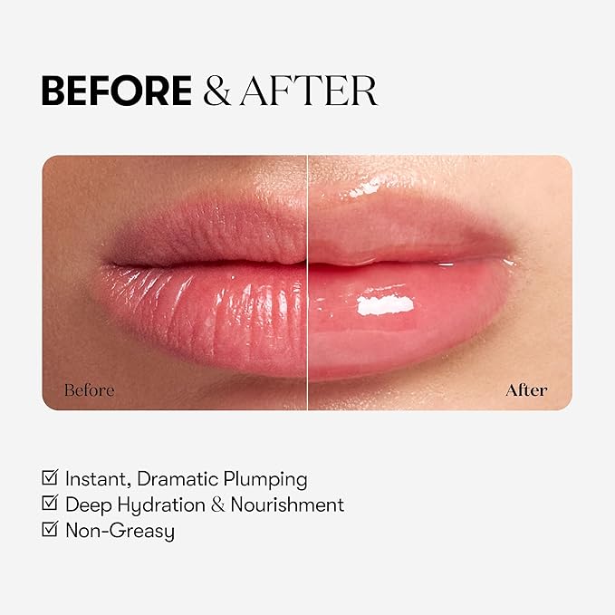 VTCOSMETICS Reedle Shot Lip Plumper, 0.15 oz (4.3 g), Moisturizing, Transparent, Lip Gloss, Fragrance-free, Korean Cosmetics (Expert)