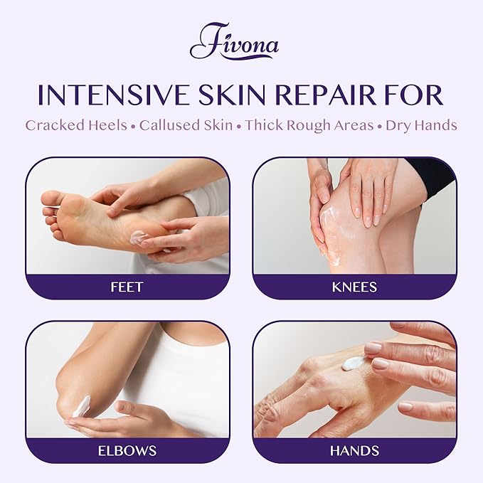 FIVONA 40% Urea Foot Cream for Dry Cracked Heels - Extra Strength Callus Softening Cream with 2% Salicylic Acid, Tea Tree & Lavender, 100g (3.5 oz)
