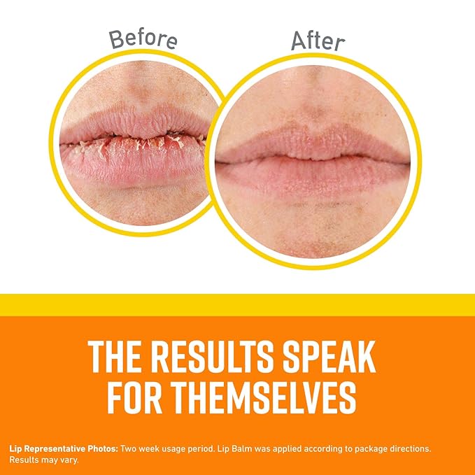 O'Keeffe's Lip Repair SPF 35 Lip Balm - Stick, Sun-Safe Moisturizer for Extremely Cracked, Dry Lips (Pack of 2)