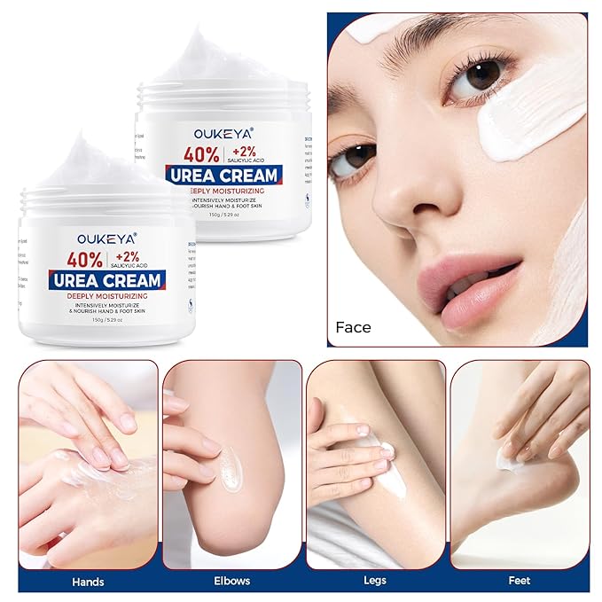 OUKEYA NEW FORMULA Urea Cream 40% Plus 2% Salicylic Acid for Feet Maximum Strength, Dry Cracked Hand Heel Moisturizing Repair Lotion for Knees, Elbows, Removes Corns, Dead Skin Cream, 5.29 oz 2 Pack
