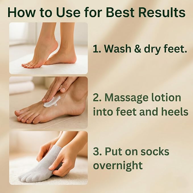 Peppermint Foot Cream for Dry Feet & Cracked Heels, Heel Repair Cream, Callus Remover w/ 5% Lactic Acid, Tea Tree Oil, Eucalyptus & Rosemary, Natural Foot Moisturizer for Dry Skin, 8 oz