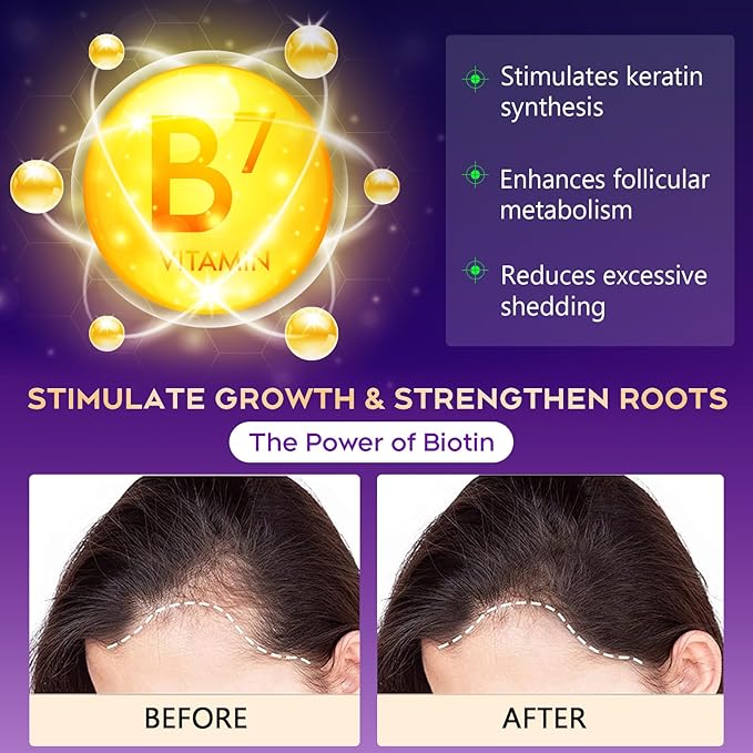 Biotin Hair Growth Shampoo, Hair Loss Shampoo for Thinning Hair for Women & Men, Strengthen Roots, Control Oil & Thicken Thin Hair, Sulfate-Free for All Hair Types, 10.1 Fl Oz-Fresh