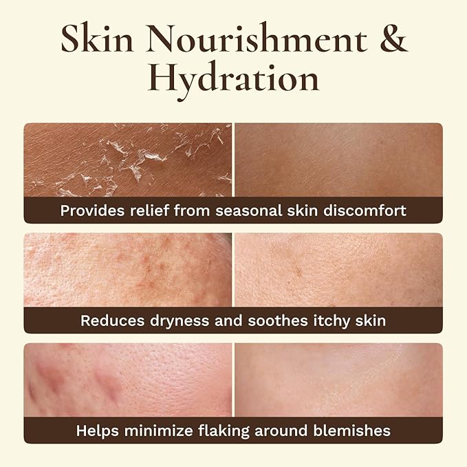 Beef Tallow for Skin Face - Tallow and Honey Balm for Face - Whipped Grass-Fed Moisturizer with Raw Honey & Beeswax - Hydrating Body Cream for Dry, Cracked and Sensitive Skin