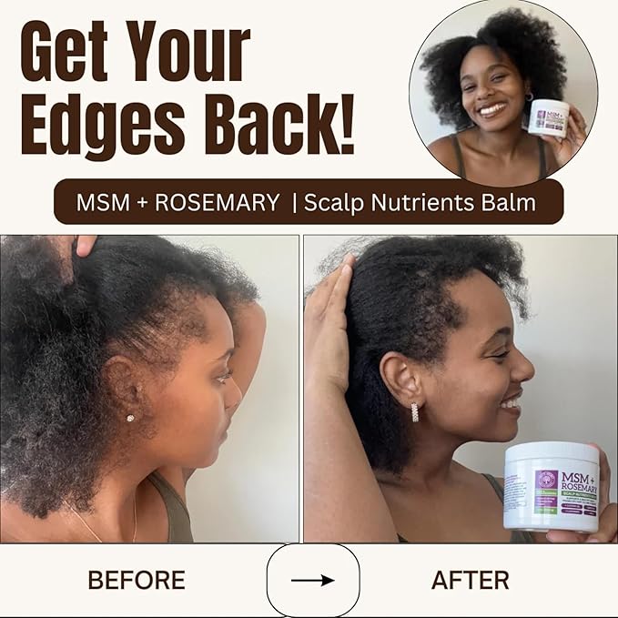 Qhemet Biologics MSM + Rosemary Scalp Nutrients Balm | Food for Hair Growth | MSM, Rosemary, Bhringraj, Castor Oil & Coconut Oil | For Dry Scalp, Thinning & Slow Growth | Vegan (4 oz)