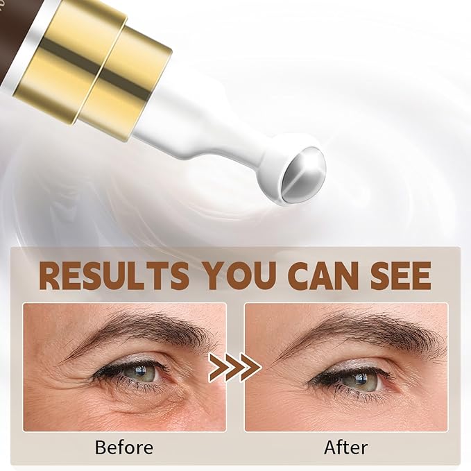 6% Caffeine Eye Cream with Retinol, Niacinamide & Collagen - Anti-Aging Under Eye Cream for Dark Circles, Puffiness, Fine Lines & Wrinkles - Smoothing & Hydrating Eye Cream for Women & Men, 0.507oz