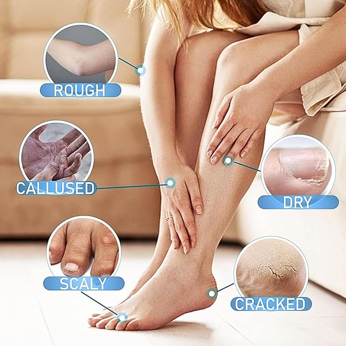 Cracked Repair Cream, 2Pcs Cream For Dry Cracked Skin, Peach Cracked Heel Stick, Rolling Use Moisturizing Balm For Dry Cracked Feet Hands And Elbows (40gx 2)