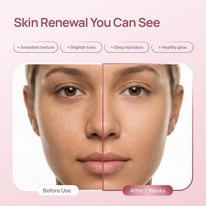 PLANTIFIQUE PDRN Exosome Reedle Shot Serum 700 PPM – Korean Skin Care Microneedling Face Moisturizer – Niacinamide, Collagen, Hyaluronic Acid, Centella – Anti Aging for Skin Barrier Repair, Glass Skin