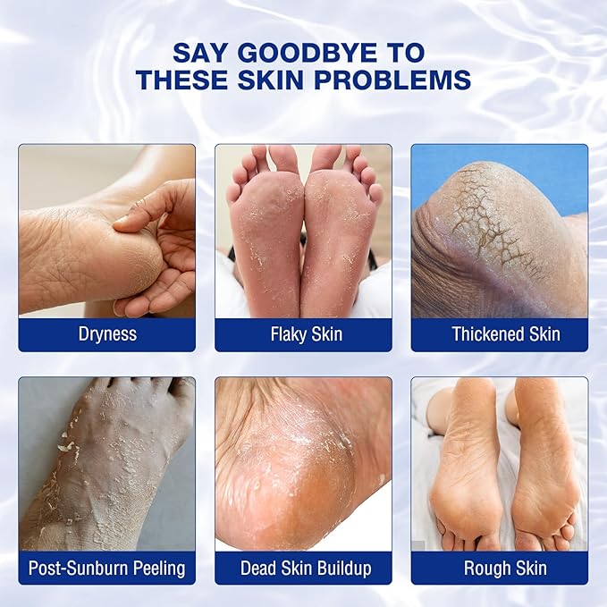 Foot Cream for Cracked Heels Cream - Extra Strength for Cracked Heels, Dry Skin & Itchy Feet – Soothes Burning, Scaling & Irritation for Men and Women
