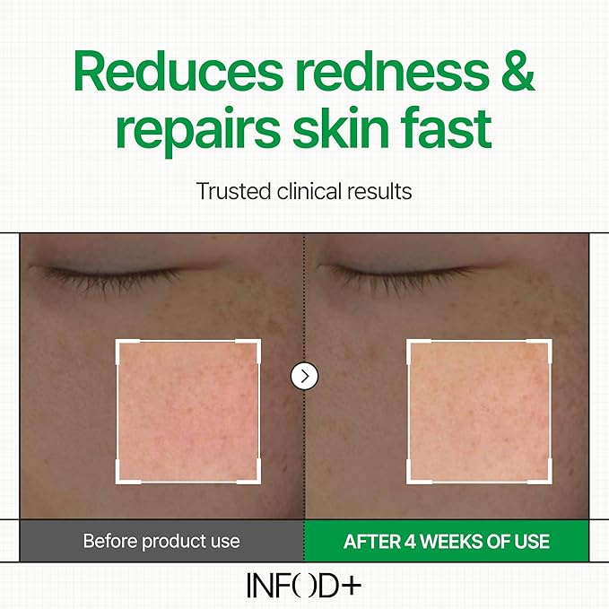 INFODPLUS Sensitive Skin Moisturizer Face Cream with Ceramide and Panthenol, Barrier Repair Support Hydrating Soothing Cream, Lightweight Calming Facial Moisturizer, Korean Skincare 1.69 fl oz, 50ml