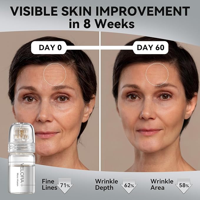 Micro Infusion System for Face - Hydrating Peptide & Hyaluronic Acid Serum Set, Skin-Smoothing Radiance Set with 0.25mm Stamp, At-Home Facial Kit, 1 Month