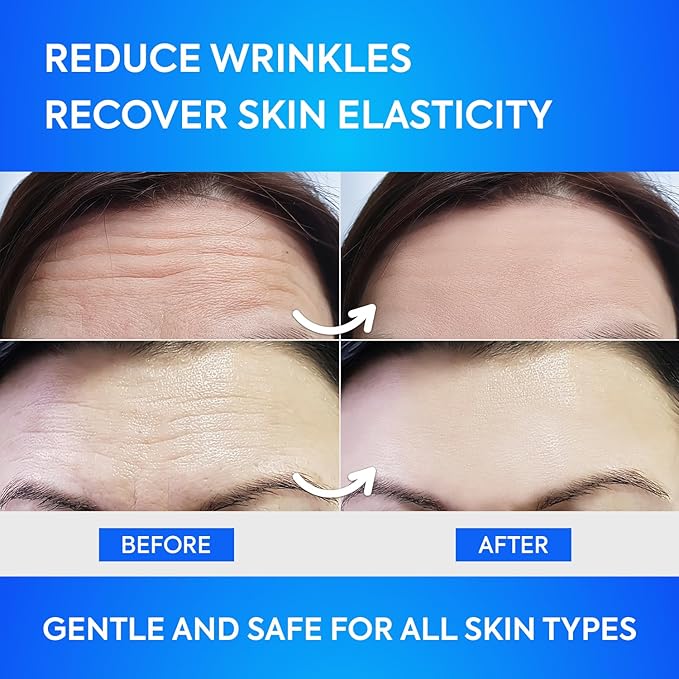 SILKDERMIS Forehead Wrinkle Patches 12Pcs with Aloe, Collagen, Vitamin E, Anti Wrinkle Patches, Forehead Wrinkles Treatment (White)
