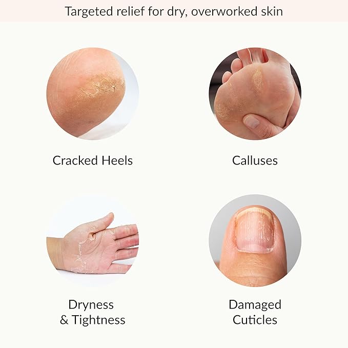 Epielle Hydrating Hand & Foot Masks, Relieve and Soften Dry, Overworked Skin, Self Care Gifts for Women, Spa Kit, Mothers Day Gifts, 6 Moisturizing Gloves & 6 Moisturizing Socks