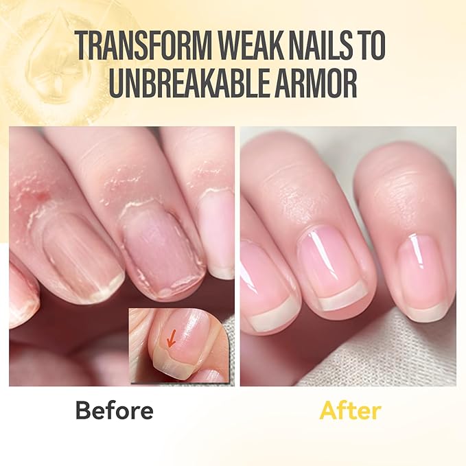 CHUCHU Vegan Cuticle Oil for Nails: Orange Jojoba Nail Cuticle Oil with Vitamin B & E for Moisturizes Cuticle and Nail's Skin - Prevents Hangnails and Chapped 15ML