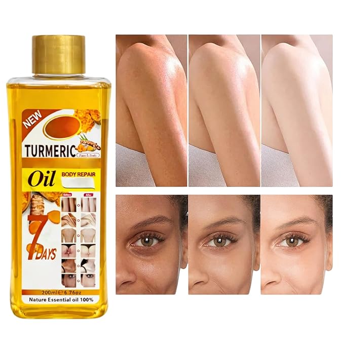 Turmeric Oil for Massage and Skin Moisturizing, Botanical Hydrating Body Oil for Dry Skin, Lightweight Spa Body Care Oil with Turmeric Extract, 200ml / 6.76 fl oz