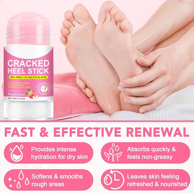 60% Urea plus 2% Salicylic Acid Foot Care Stick, Deep Hydration Soften & Smooth Thickened Areas, Intensive Moisturizer Repairs for Dry, Cracked Heels & Thickened Skin (1.41 Ounce, Peach)
