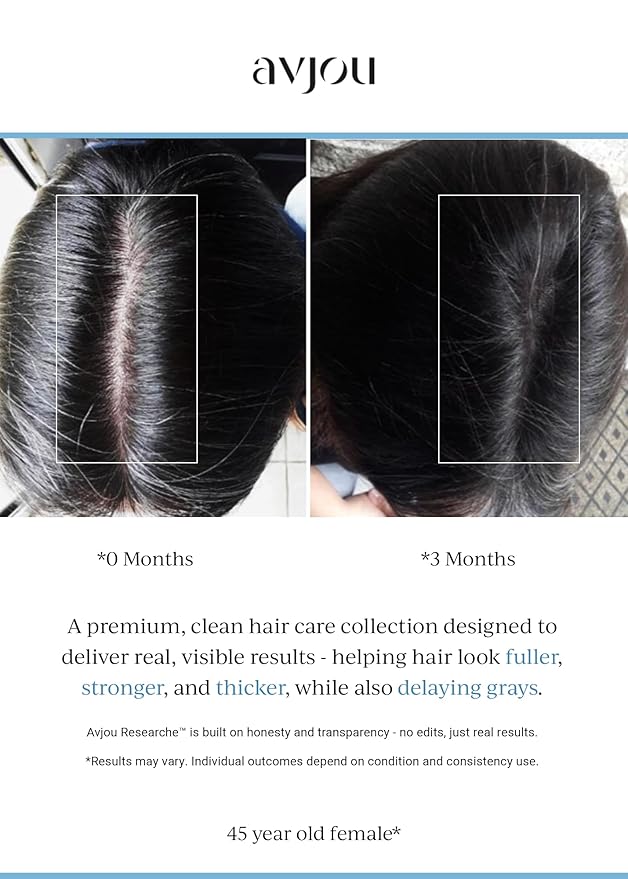 Avjou Researche™ Scalp Serum – Thicker, Fuller-Looking Hair + Targets Visible Signs of Premature Greying – 3 Patented Ingredients – Backed by Cosmetic Science – Oil-Free, All Hair Types, 1.7 oz