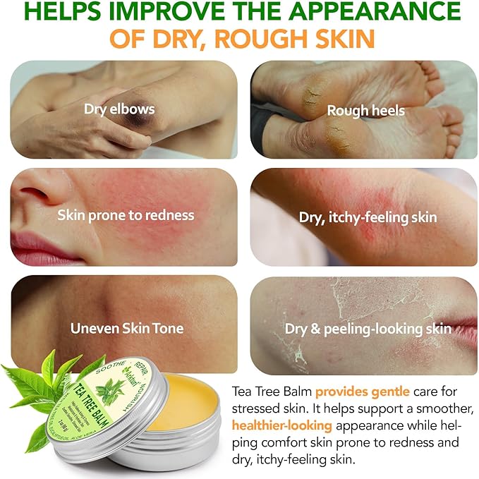 ABOUME Tea Tree Oil Balm, Tea Tree Balm Help Dry, Itchy & Fungal-Prone Skin, Soothing Moisturizing Balm Suitable for Feet, Heels, Hands & Body, Natural Formula, 60g (1PCS)