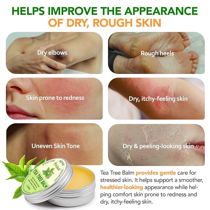 Tea Tree Oil Balm, Tea Tree Oil for Skin, Tea Tree Oil Balm for Dry Skin Relief - Irritated Skin, Cracked Heels - Organic & Safe for All Ages (2 Pack)