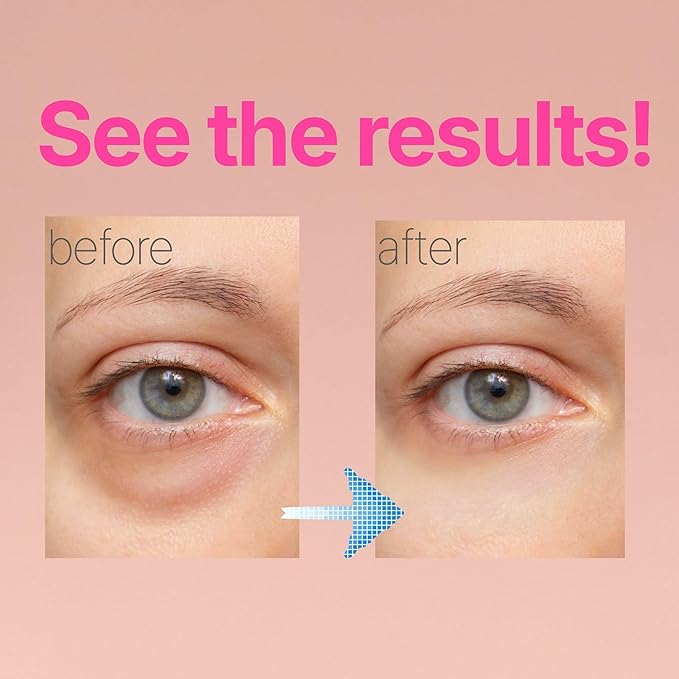 ISOI Rose Eye Concentrate with Arbutin, Adenosine & Bulgarian Rose Oil, Hydrating Eye Cream for Fine Lines & Puffiness, Korean Skin Care for Sensitive Types (0.57 fl oz, 17ml)