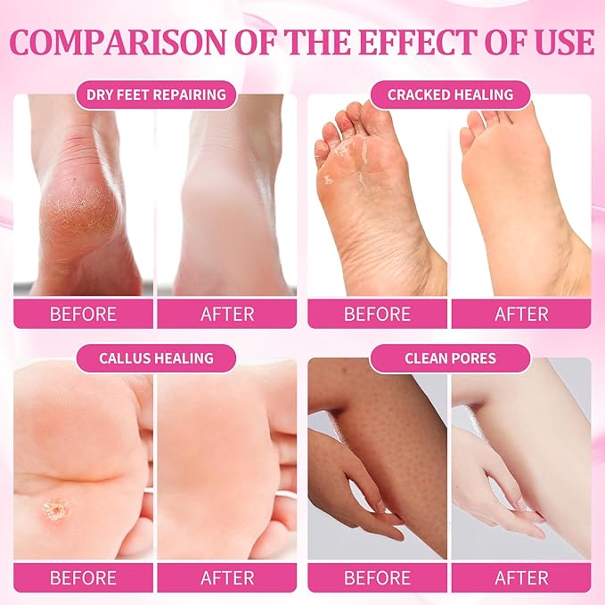 Pedicure Kit Foot Soak Set: Bubble Salt, Sugar Scrub, Massage Mask, Massage Lotion in a Box, 4 Step Foot Spa Kit for Dry Feet, Softens Calluses, Soothes Sore, Tired Feet（3 Set Rose